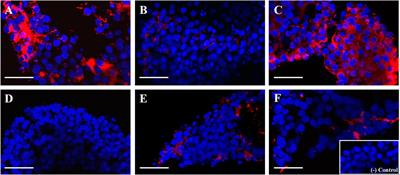 Interaction between epidermal growth factor receptor and C-C motif chemokine receptor 2 in the ovulatory cascade